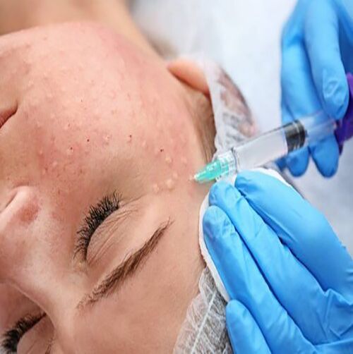 Mezoterapi / Mesotherapy