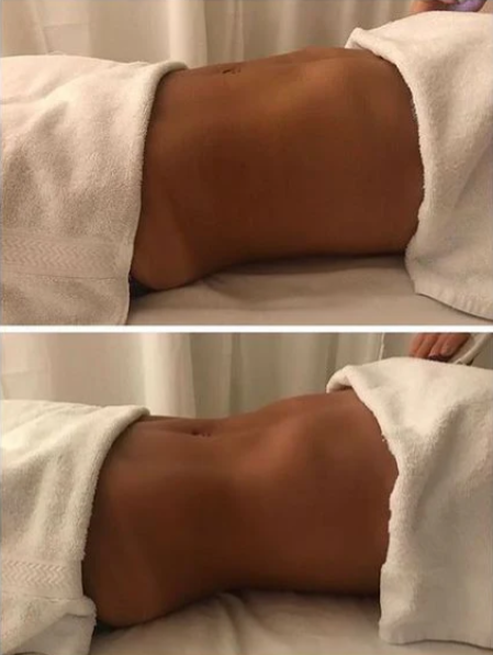 MASAZH SLIMING - SLIMING MASSAGE