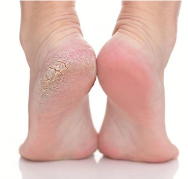 TRAJTIM I KEMBEVE VETEM ME SCRUB - FOOT SCRUB TREATMENT ONLY
