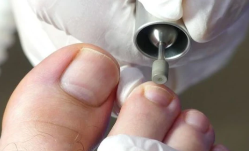 TRAJTIM I KEMBEVE VETEM ME SCRUB - FOOT SCRUB TREATMENT ONLY