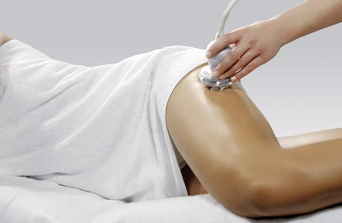 RADIO FREKUENCE -RADIO FREQUENCY