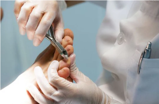 RIPARIM I THOIT TE KEMBES me Polixhel -TOE REPAIR with Poligel