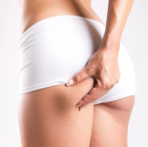 MASAZH ANTICELULIT -ANTI-CELLULITE MASSAGE